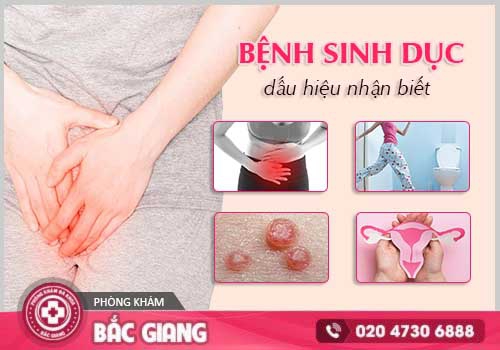Bệnh sinh dục nữ