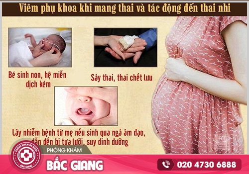 Bệnh viên siêu âm thai uy tín tại Bắc Giang