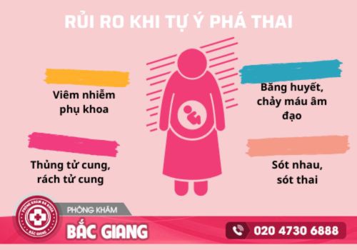 thuốc xổ thai