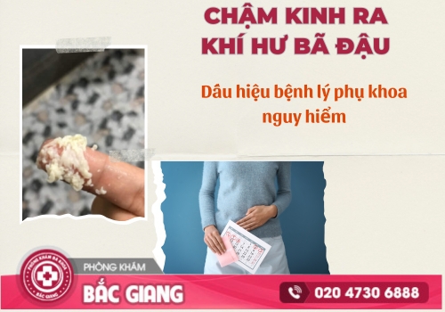 chậm kinh ra khí hư bã đậu