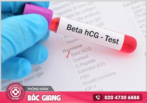 Chậm kinh sau quan hệ có phải là dấu hiệu mang thai?