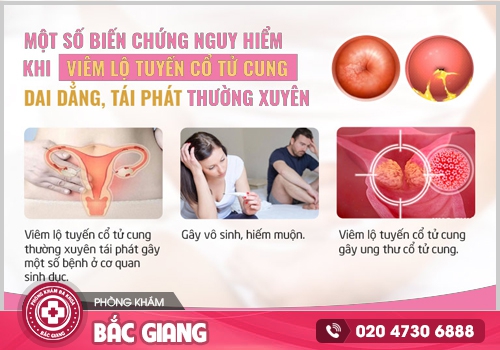 Viêm lộ tuyến cổ tử cung độ 1