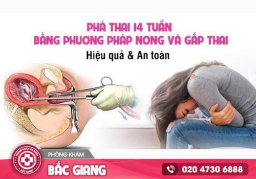 chi phí phá thai 14 tuần