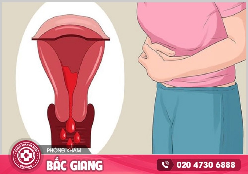 Dấu hiệu mang bầu chị em cần lưu ý để thăm khám và xử lý kịp thời