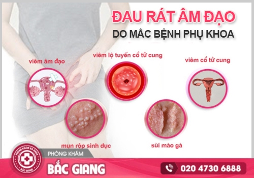 đau rát âm đạo