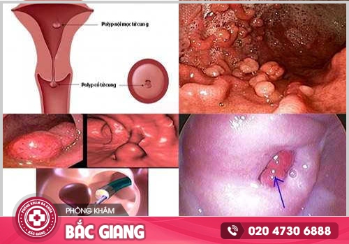 Kinh nguyệt đến tháng sớm - Dấu hiệu báo động cơ thể đang gặp vấn đề