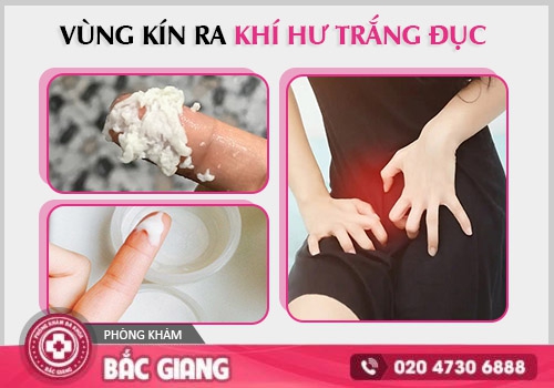Vùng kín ra dịch trắng đục bất thường