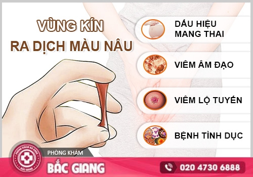 Vùng kín ra dịch nâu là bệnh gì? Khi nào cần đi khám bác sĩ?