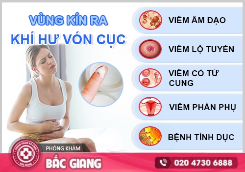 khí hư vón cục