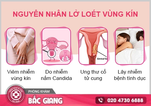 Lở loét âm đạo là dấu hiệu của bệnh gì?