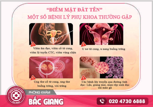 khí hư bất thường