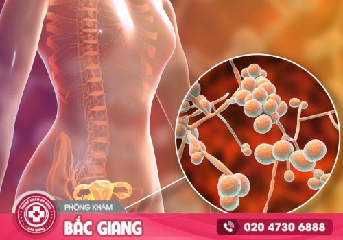 nấm candida