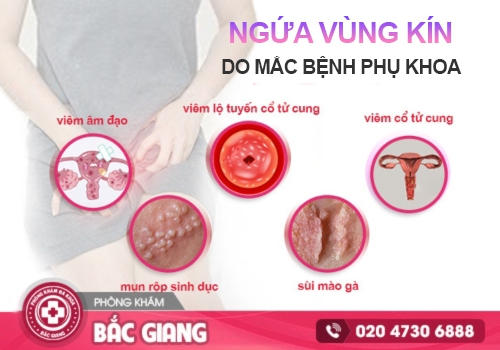 cô bé bị ngứa