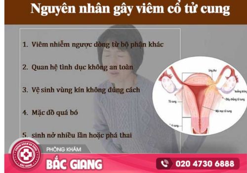 viêm cổ tử cung