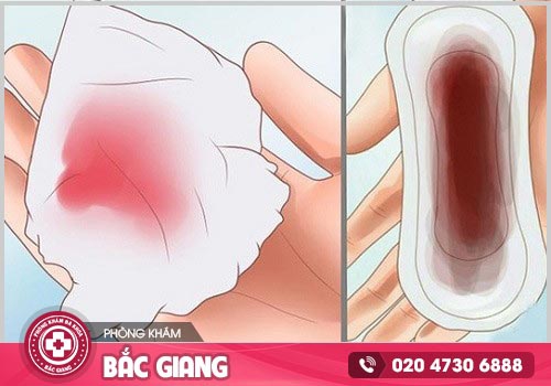 Nhận biết máu báo thai chính xác