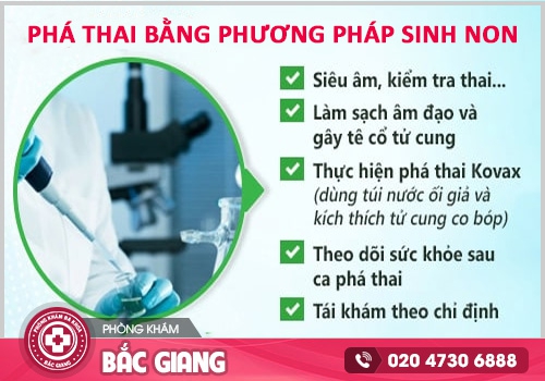 Tư vấn phá thai bằng phương pháp sinh non