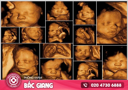 Phòng khám siêu âm thai - Sự lựa chọn tốt cho sức khoẻ của bạn