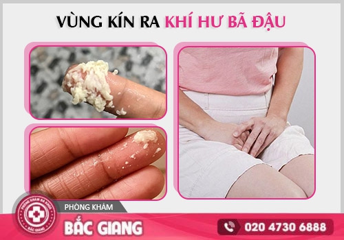 Khí hư bã đậu