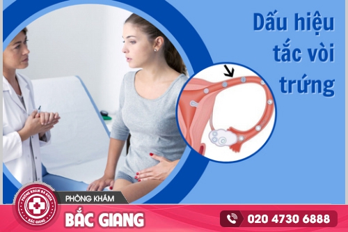 Tắc ống dẫn trứng nguyên nhân gây vô sinh ở nữ giới