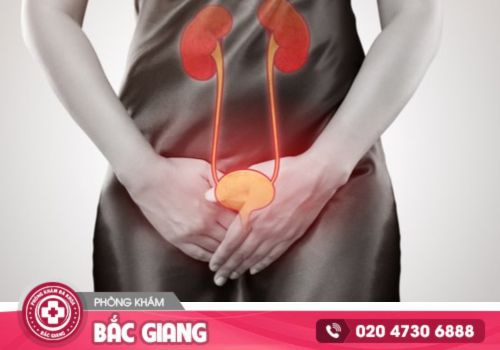 thuốc chữa viêm đường tiết niệu nữ