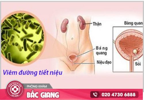 thuốc chữa viêm đường tiết niệu nữ