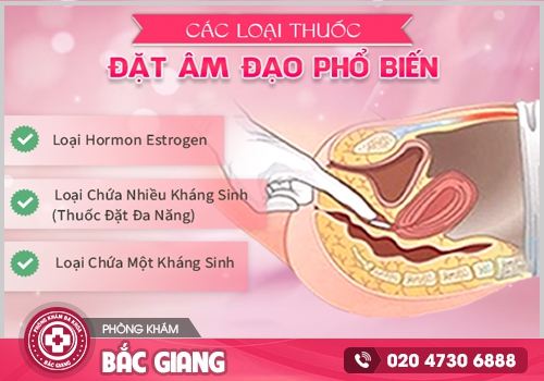 Các loại thuốc đặt âm đạo - Dùng như thế nào đúng cách?