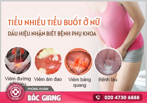 Tiểu nhiều lần ở nữ: Nguyên nhân, dấu hiệu và cách chữa