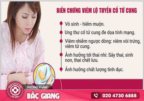 Viêm nội tuyến cổ tử cung là gì? Cách chữa trị ra sao?