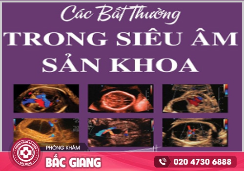 Giá siêu âm thai bao nhiêu tiền? Nên siêu âm ở đâu?