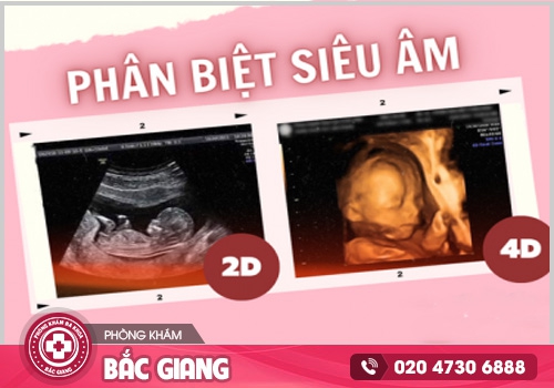 Giá siêu âm thai bao nhiêu tiền? Nên siêu âm ở đâu?