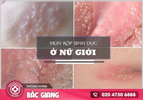 Hình ảnh ngứa vùng kín nữ - Kiểm tra xem bạn có đang mắc phải bệnh phụ khoa?