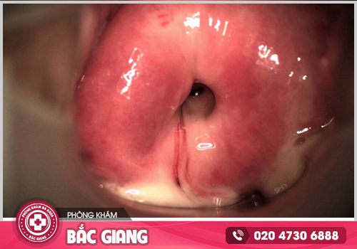 Hình ảnh ngứa vùng kín nữ - Kiểm tra xem bạn có đang mắc phải bệnh phụ khoa?