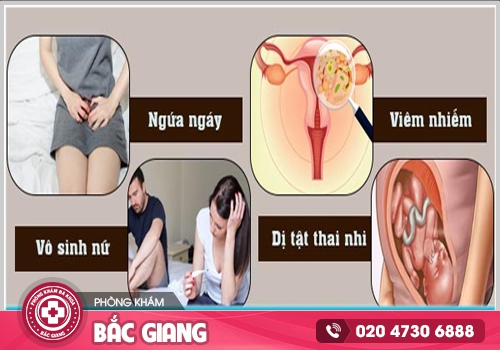 Hình ảnh ngứa vùng kín nữ - Kiểm tra xem bạn có đang mắc phải bệnh phụ khoa?