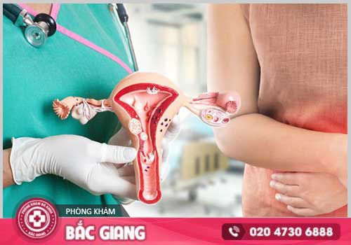 Thuốc đặt phụ khoa - Bạn đã sử dụng đúng cách?