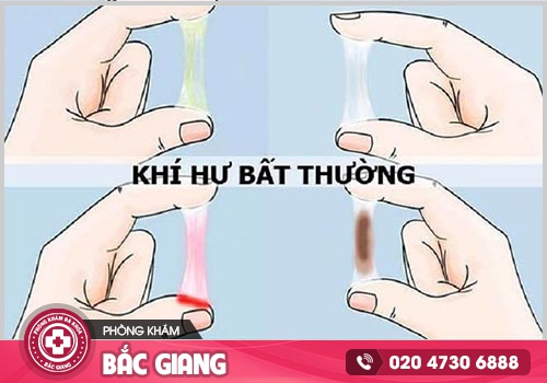 Nhiễm trùng âm đạo là gì? Nguyên nhân và dấu hiệu nhận biết như thế nào?