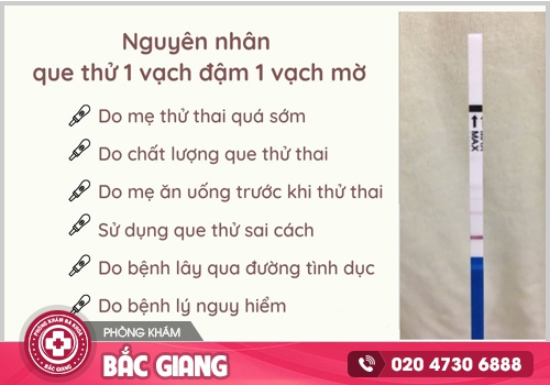 Vì sao que thử thai 1 vạch đậm 1 vạch mờ?