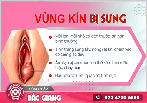 Sưng vùng kín nữ dấu hiệu của các bệnh phụ khoa