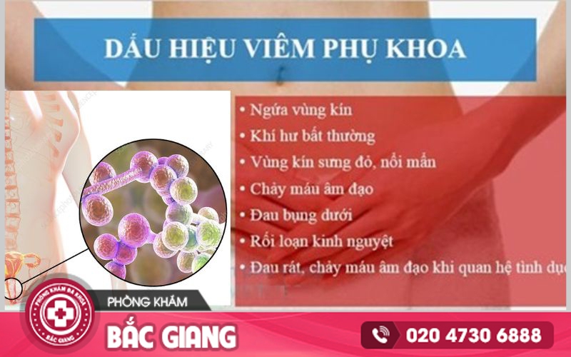 Những dấu hiệu viêm phụ khoa nhẹ ở nữ giới. viêm phụ khoa nhẹ